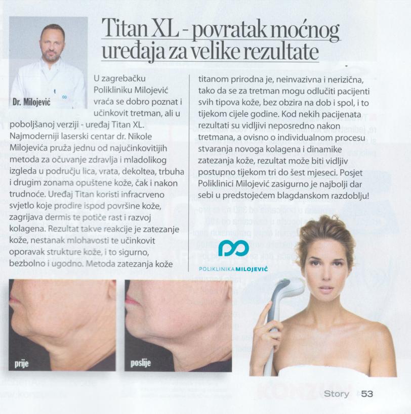 Časopis Story: "Titan XL - povratak moćnog uređaja za velike rezultate"