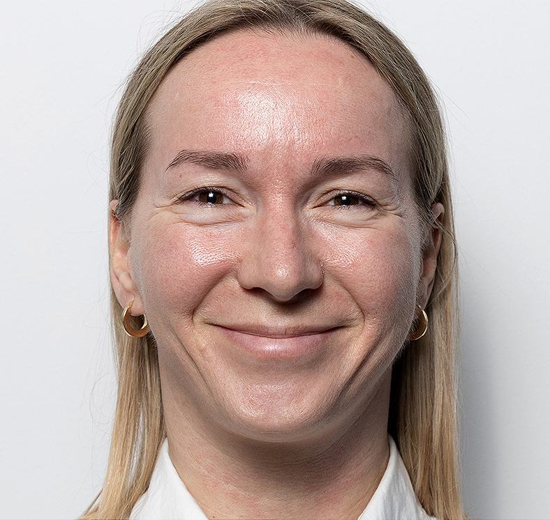 Injekcije za bore, Botox, sl. 2 - prije