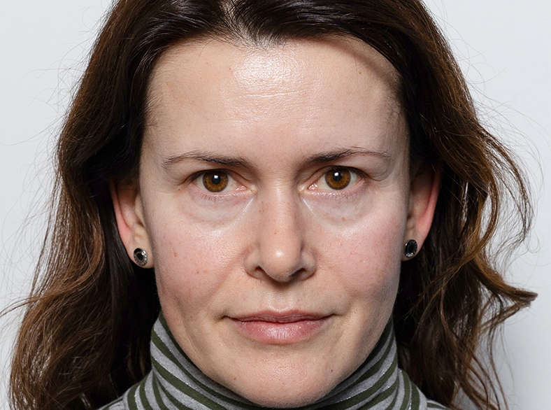 Nekirurško uklanjanje podočnjaka, prije