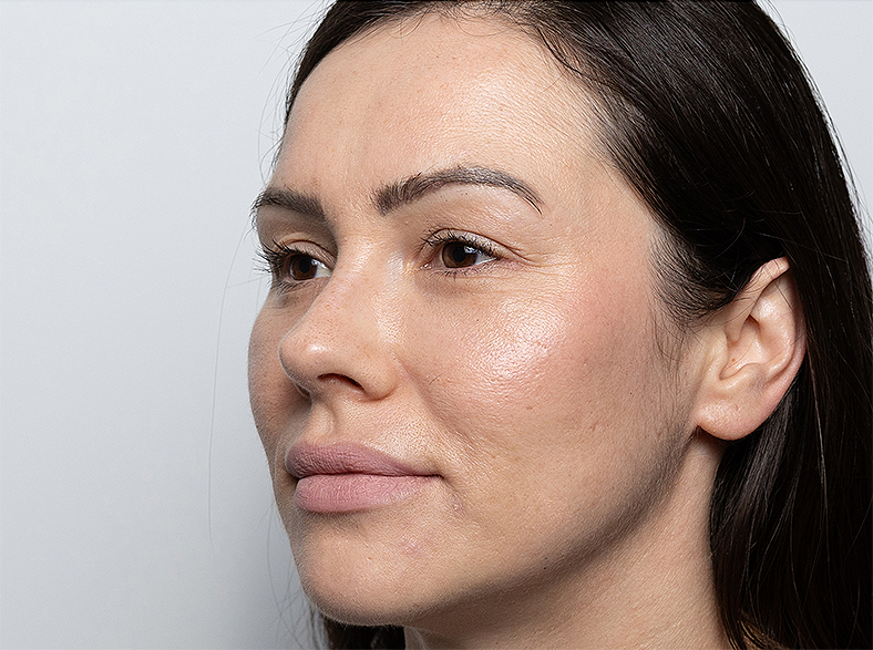 Oblikovanje obraza - poslije 1