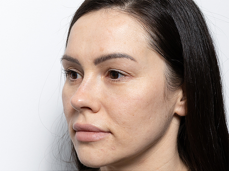 Oblikovanje obraza - prije 1