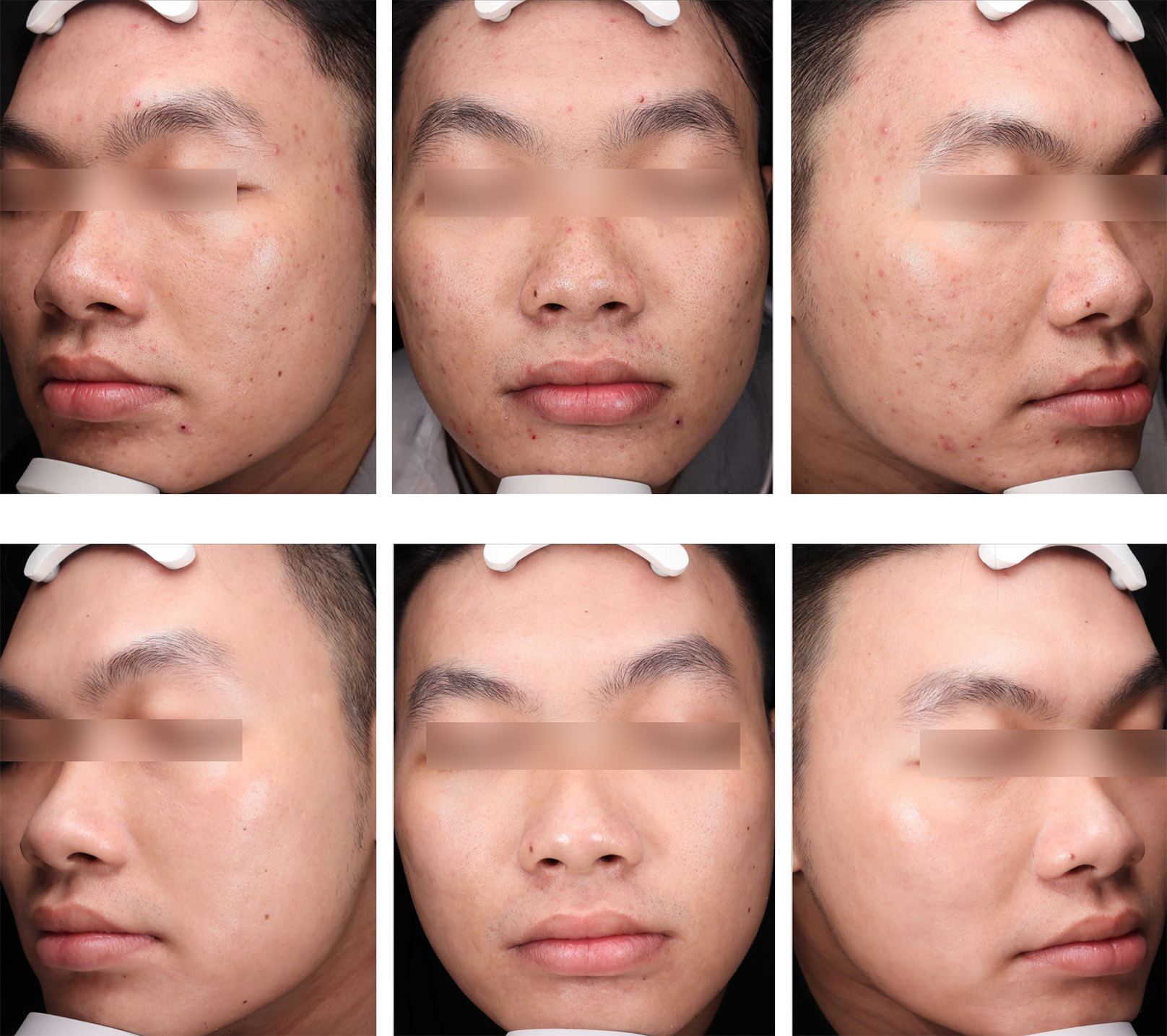 UltraClear 3D Miracl - Radiance, sl. 1
